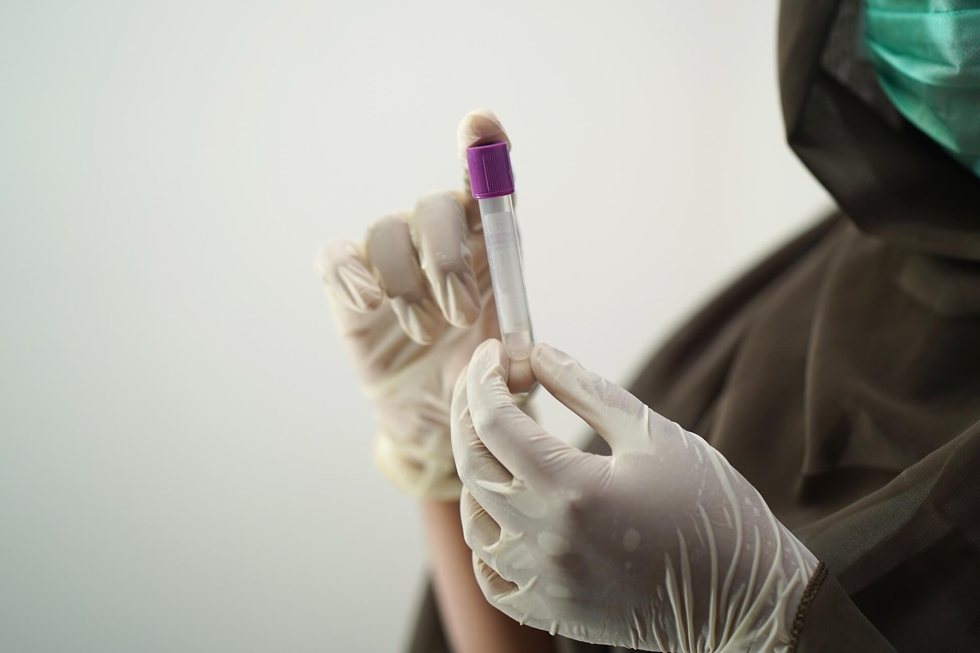 scientist holding lab vial